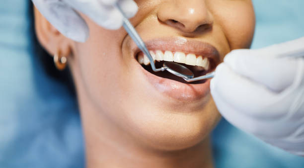 Best Emergency Dentist for Lost Fillings or Crowns in Granby, MO